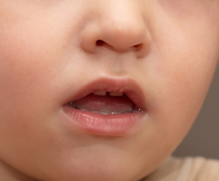 Η κακοσμία του στόματος – Συμβουλές για την αποφυγή της